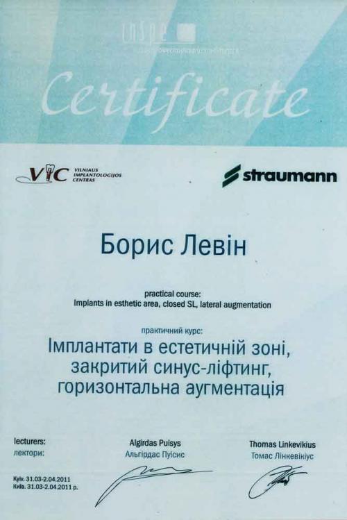 Имплантаты в эстетически значимой зоне