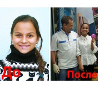 Ранее лечение брекетами