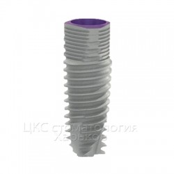 implant mis v3