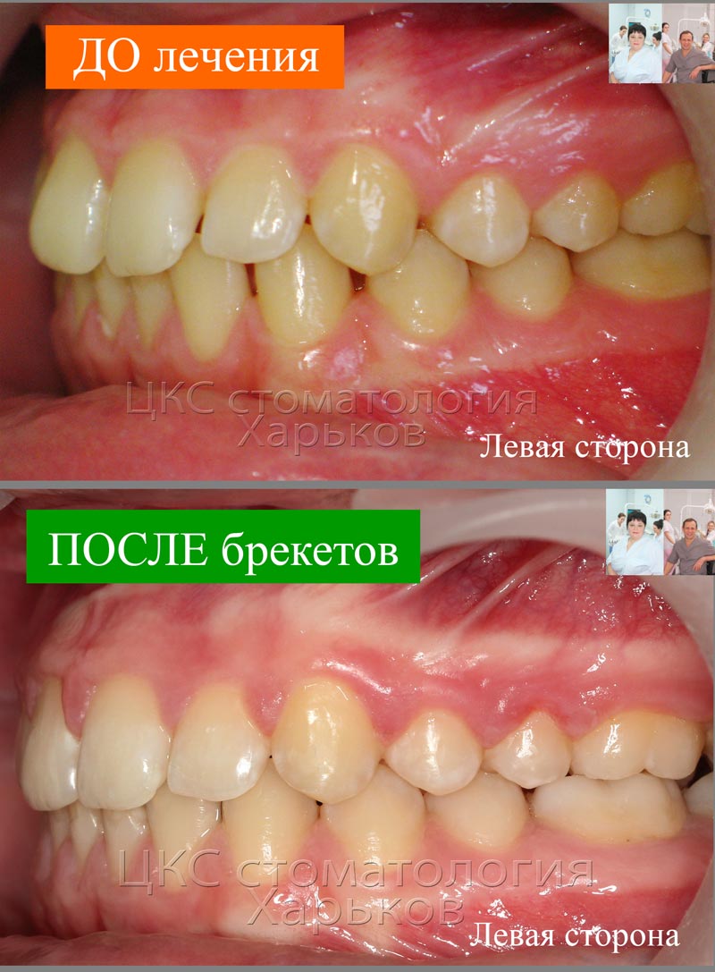 ДО и ПОСЛЕ