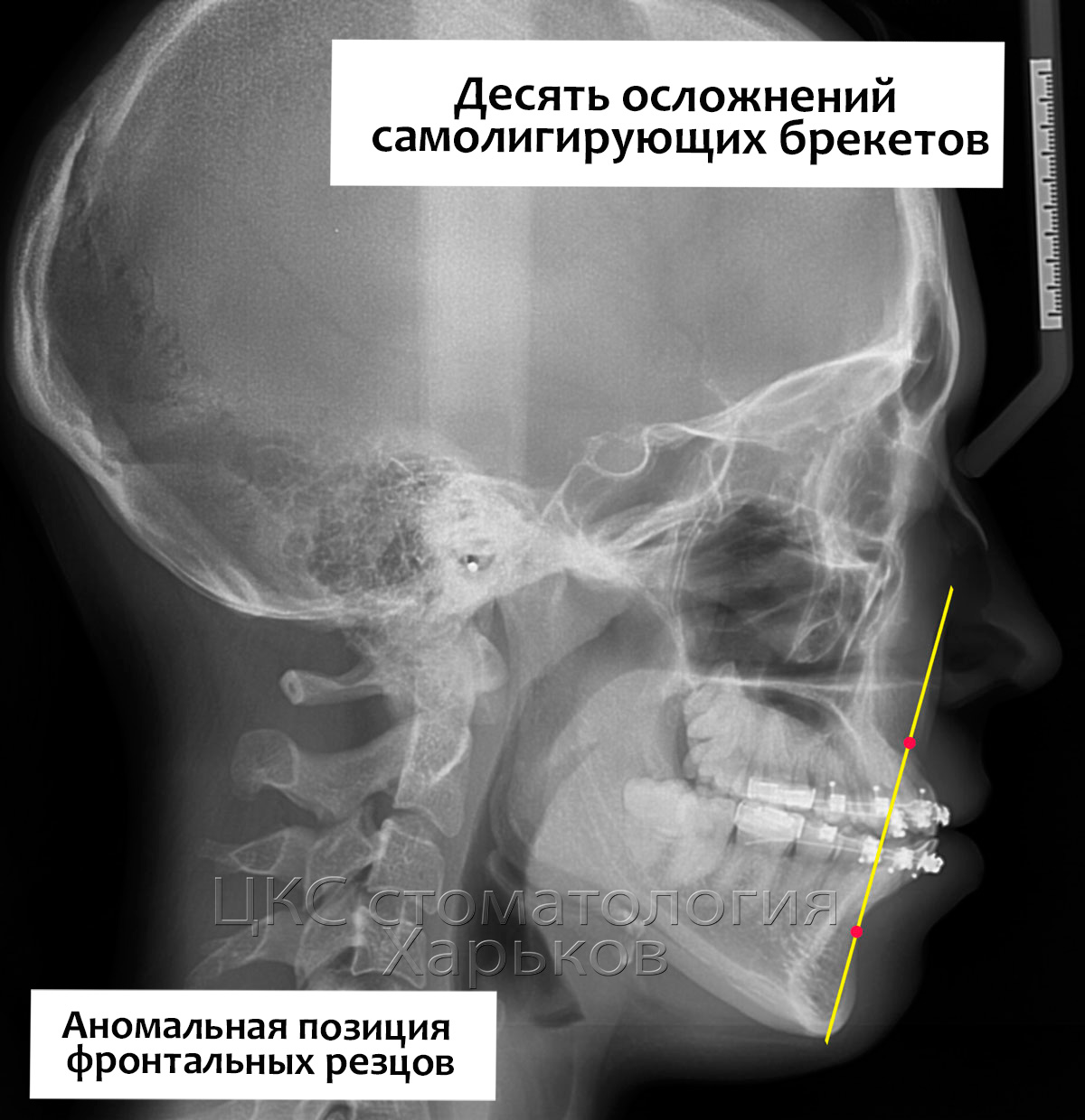 Аномалии строения лицевого скелета