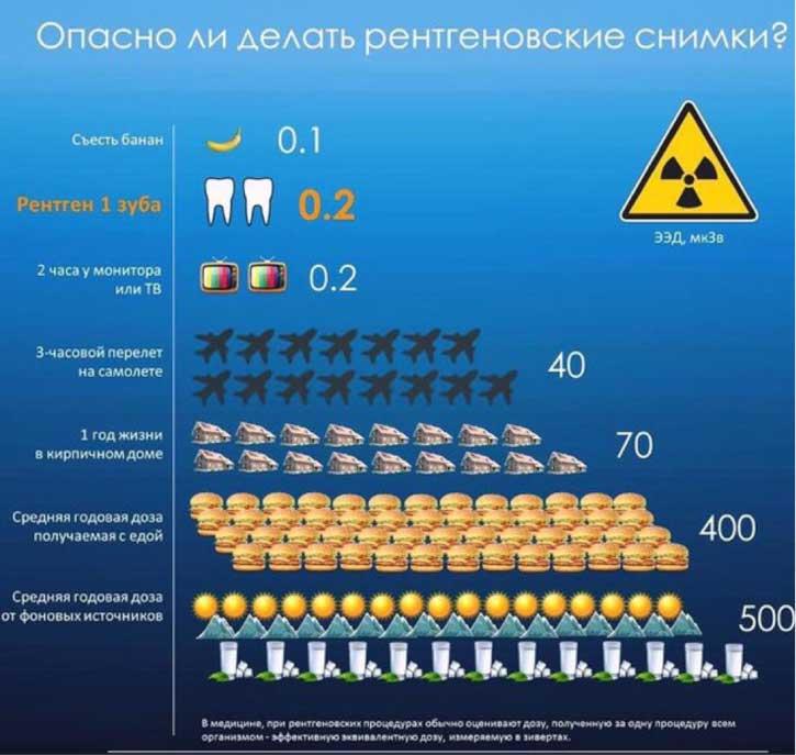 Лучевая нагрузка стоматологическая рентгенография