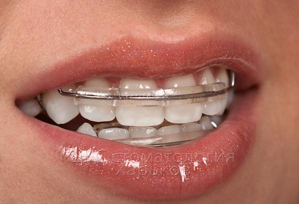 retainer