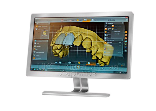 моделирование inlab