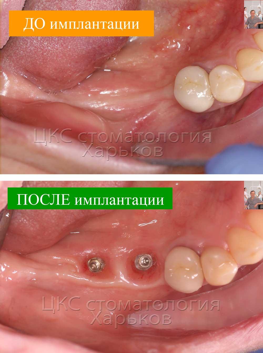 ДО и ПОСЛЕ стоматологического лечения