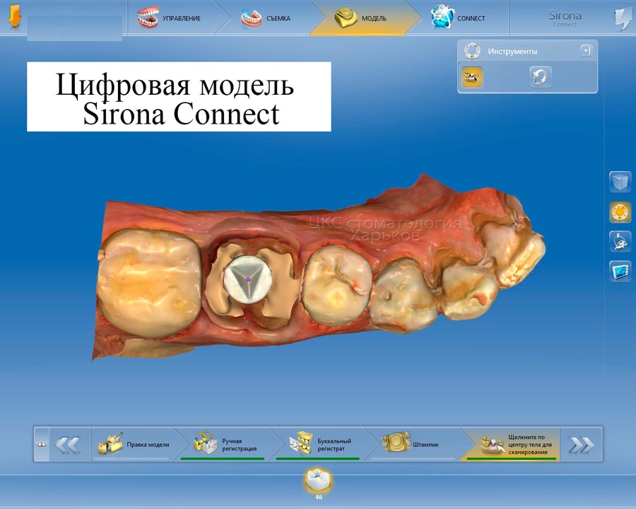 Цифровая стоматология в Харькове