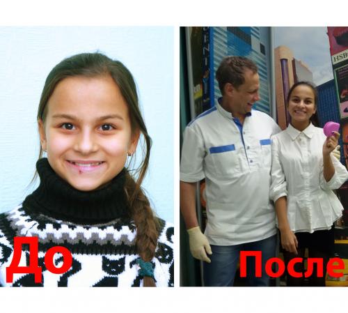 2016_12_10_до_после