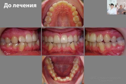 2017_01_03_долечения