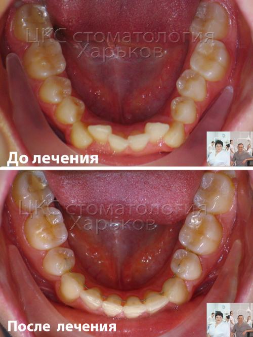 2017_01_03до_после2