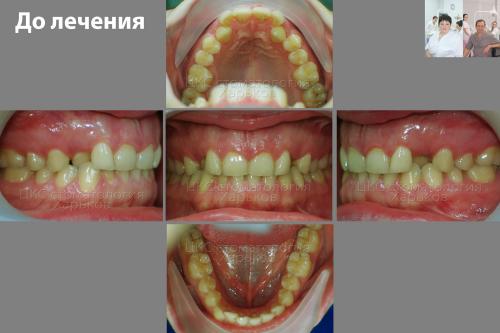 2017_02_17_до
