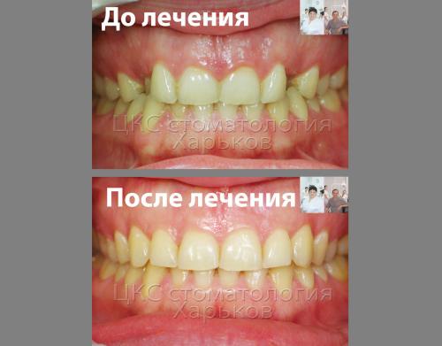 2017_02_17_до_после1