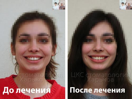 2017_03_21улыбка