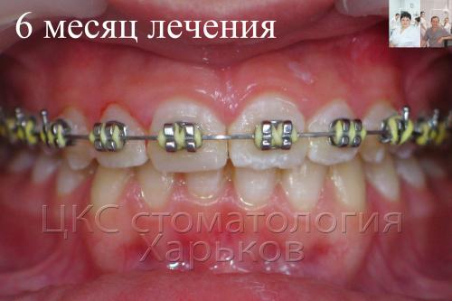 Фото через 6 месяцев успешного лечения