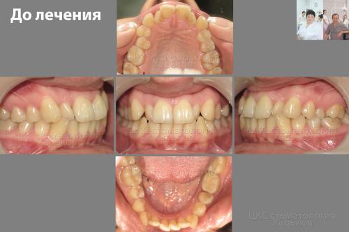 до_31_01_17
