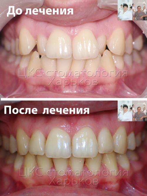 до_после_31_01_17