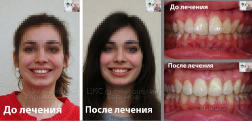 инстаграм