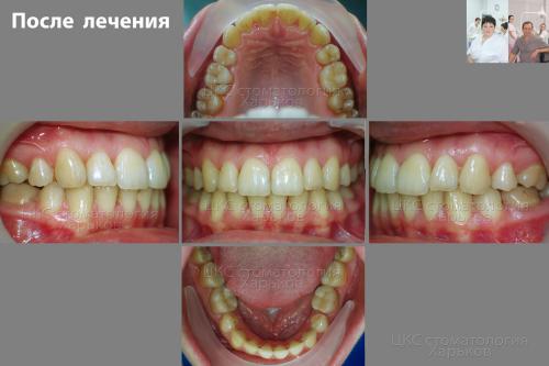 после_31_01_17