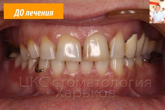 Некрасивые зубы