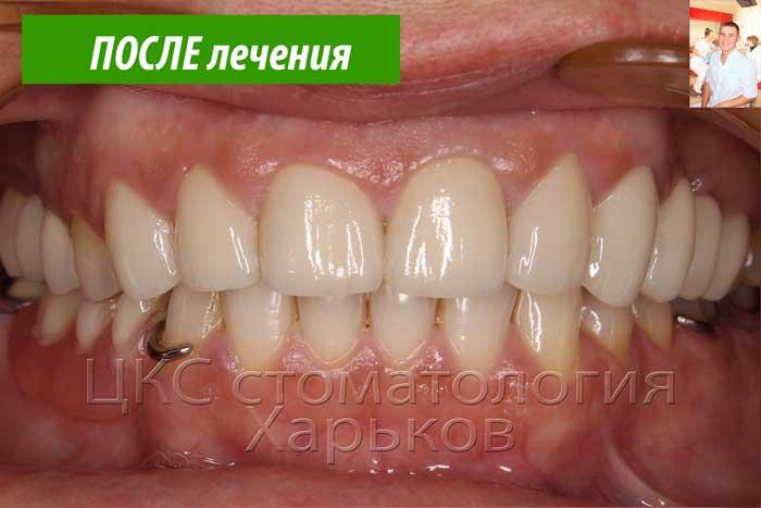 Красивые, белые зубы