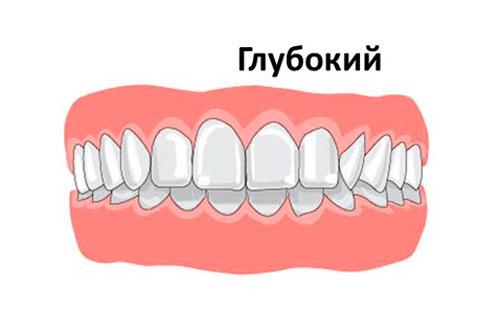глубокий