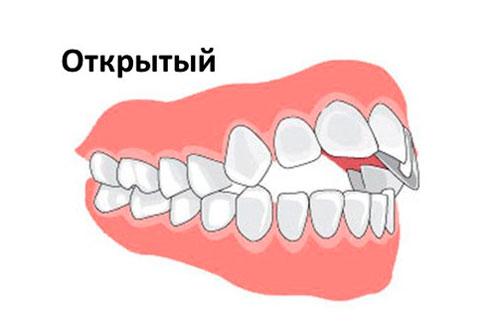 открытый