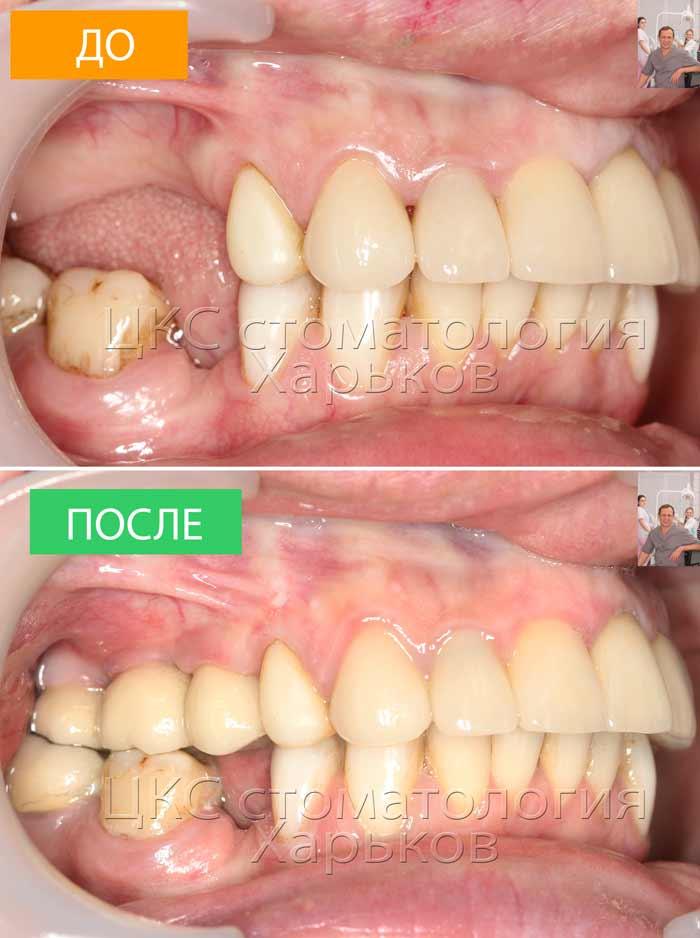 ДО и ПОСЛЕ лечения