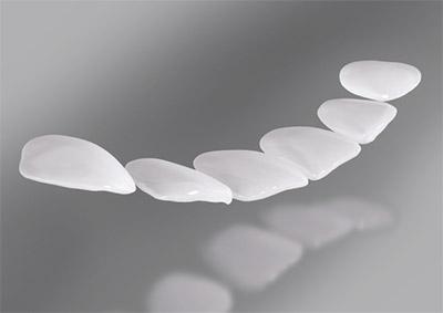ceramic veneers
