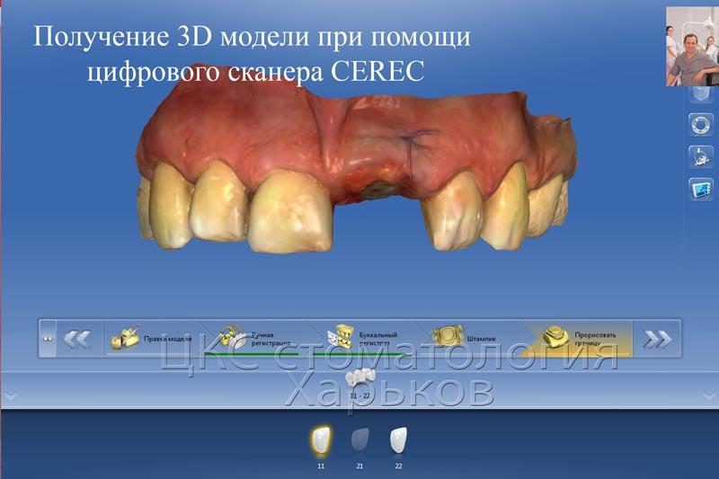 Результаты 3D сканирования