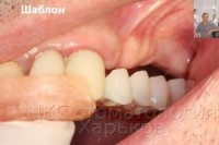 Хирургический шаблон