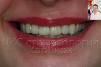 Стоматологическое чудо преображения улыбки